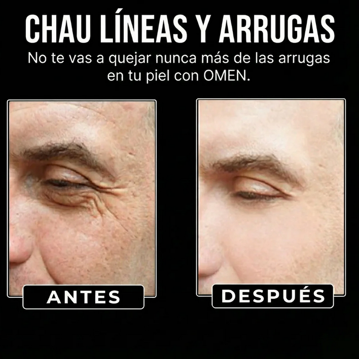 OMEN- SERUM ANTI-EDAD PARA HOMBRES