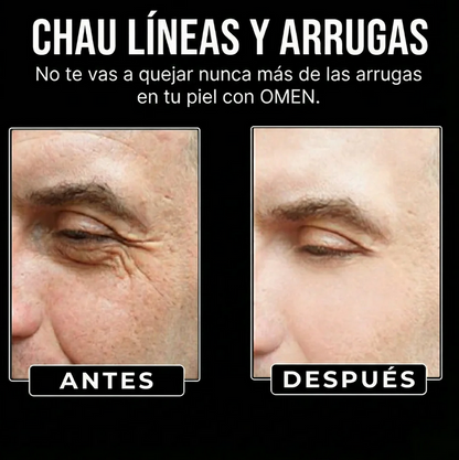 OMEN- SERUM ANTI-EDAD PARA HOMBRES