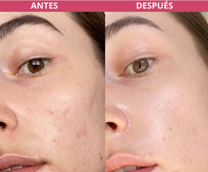 LABIF-CREMA SUPER HIDRATANTE Y TAPA POROS