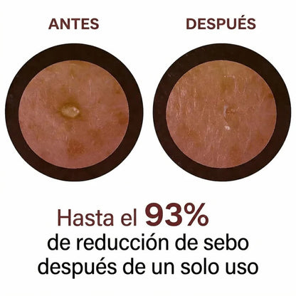 EXFOLIANTE ARROZ NEGRO-ELIMINA PUNTOS NEGROS Y EXFOLIA TU PIEL