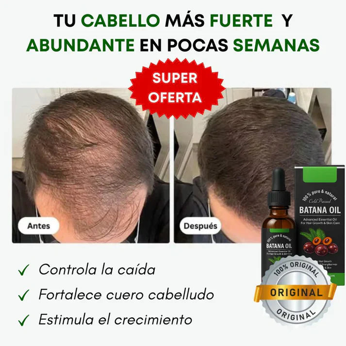 BATANA OIL: Activa el Crecimiento