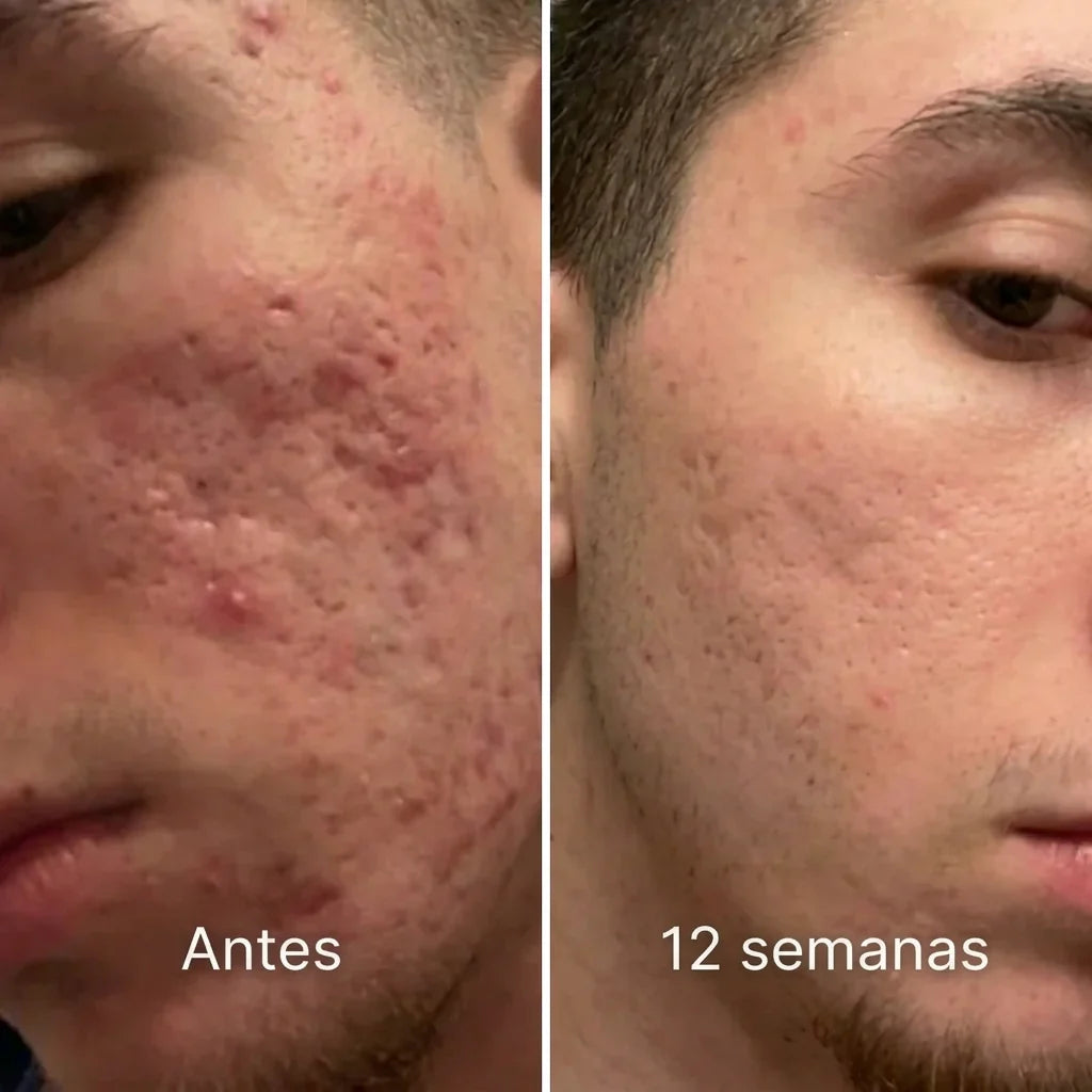 BALSAMO REPARADOR DE CICATRICES